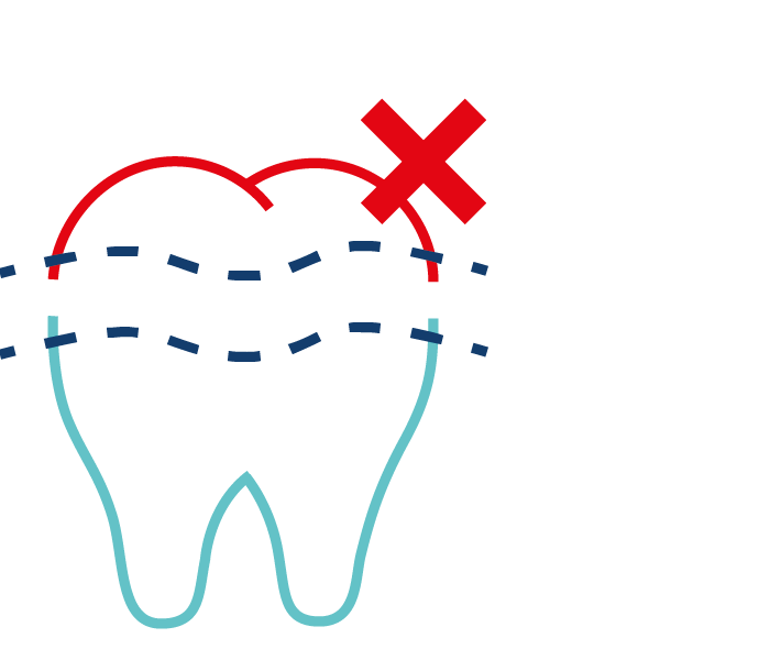 removal of infected root tips