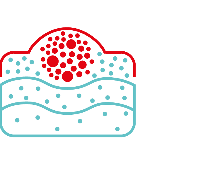 soft tissue removal